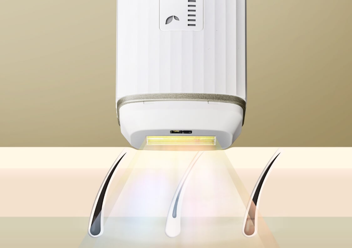 IPL方式採用