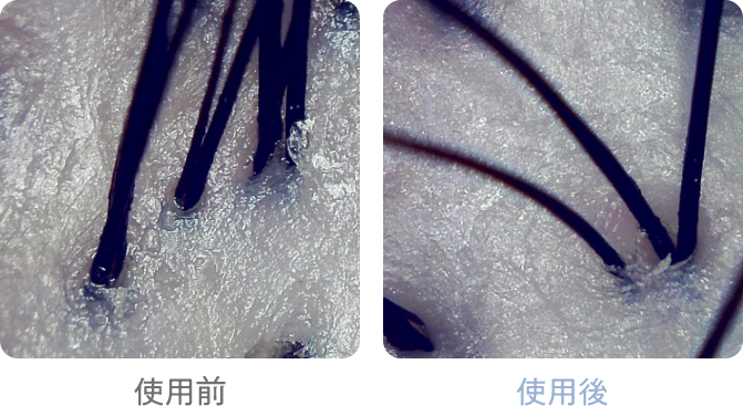 落としにくい頭皮の皮脂汚れもすっきり