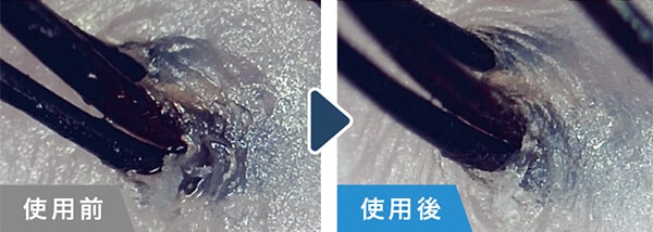 頭皮の汚れもスッキリ