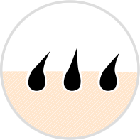 毛が多い時