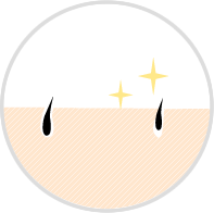 ほとんど毛が気にならなくなった時