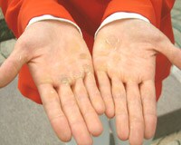 岩本選手の手にはたくさんのまめが・・